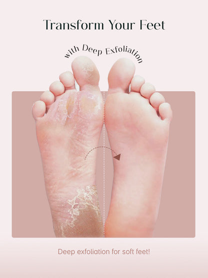SeoulSkin Glycolic Acid Foot Peeling Mask