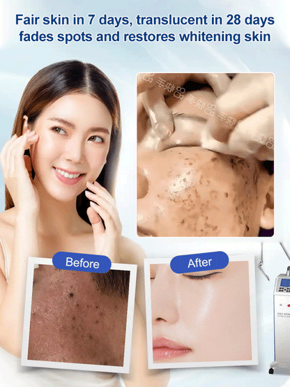 💧 Spot Fading Urea Cream – Korean Cream ⭐